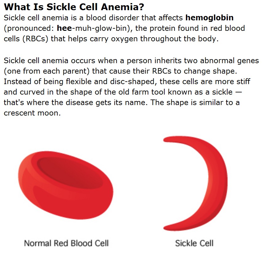 sickle-cell2